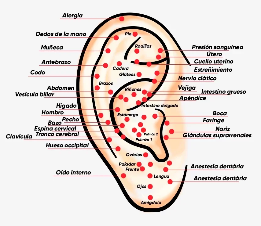 auriculoterapia
